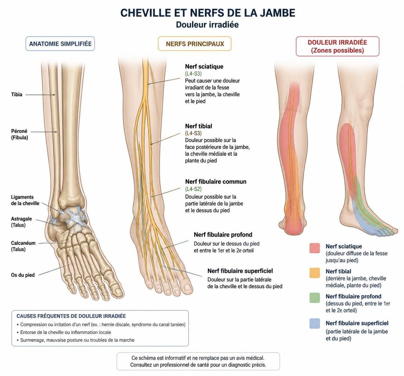découvrez les causes possibles de la douleur à la cheville qui irradie dans la jambe, avec des conseils pour mieux comprendre et gérer ce symptôme.