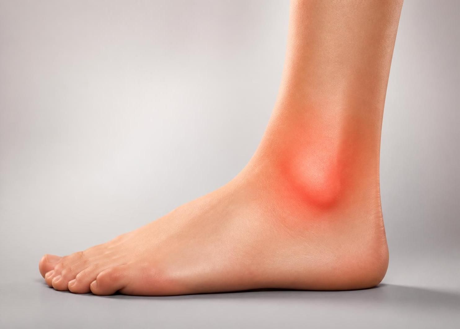 découvrez les causes possibles de la douleur à la cheville sans gonflement ni bleu et comment identifier les symptômes pour mieux comprendre et traiter cette gêne.